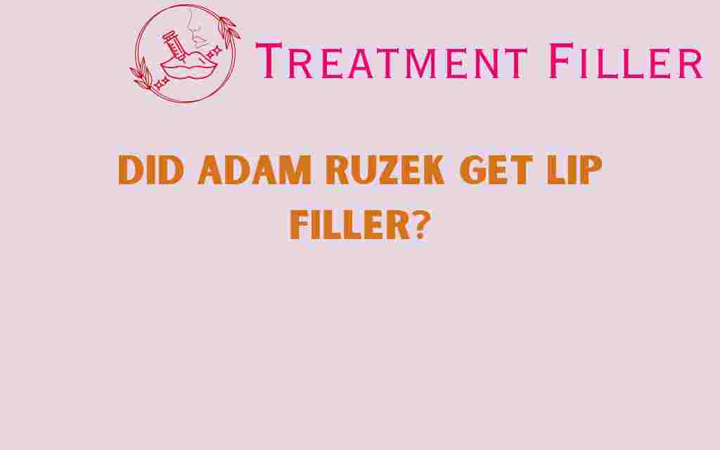 did-adam-ruzek-get-lip-filler